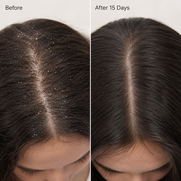 Menthol & Mint Anti-Dandruff Shampoo
